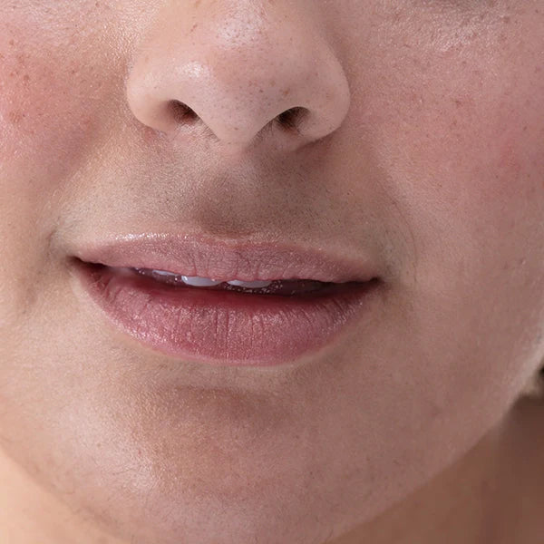 How to Tell the Difference Between Sensitive and Sensitized Skin
