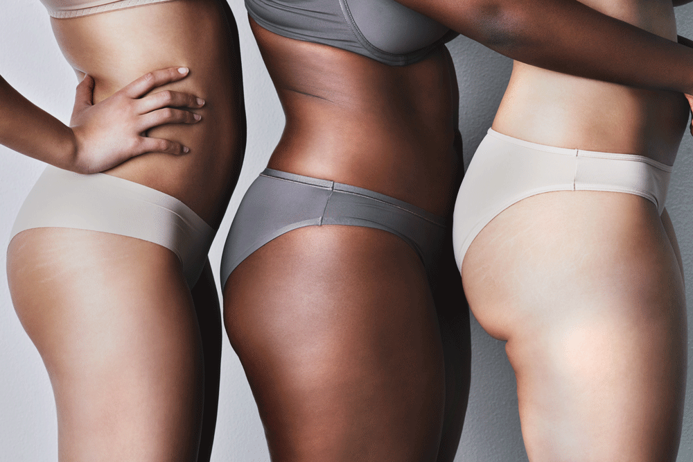 Diverse Women Standing in Undergarments