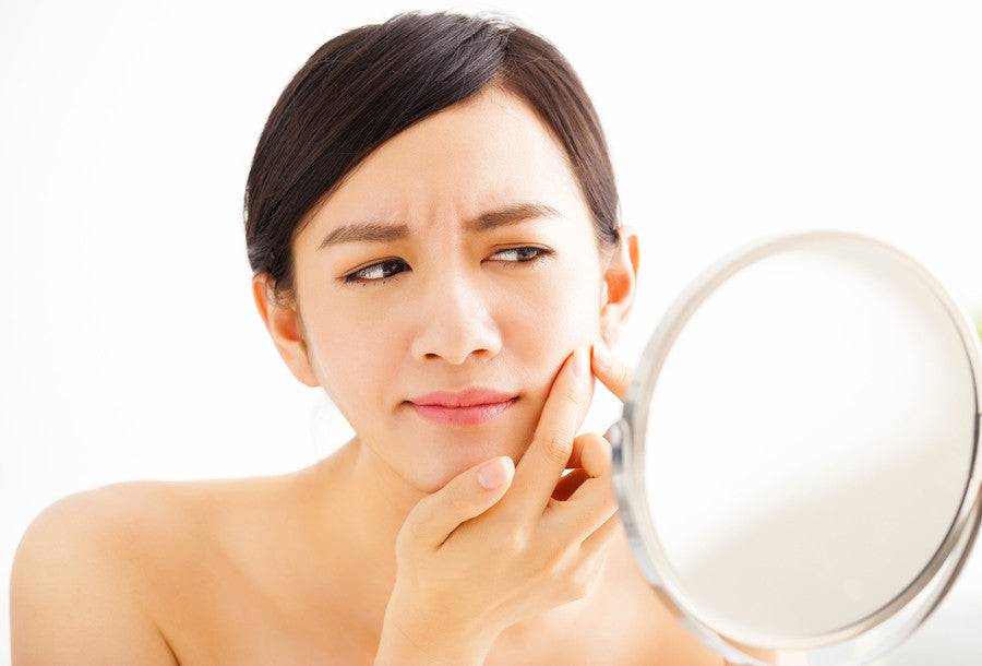Best Essential Oils for Acne Prone Skin