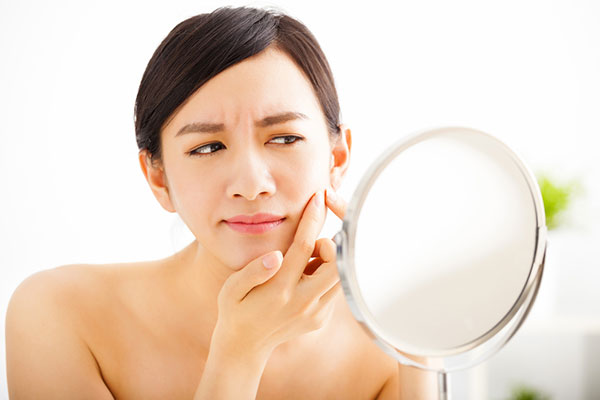 Acne Skin