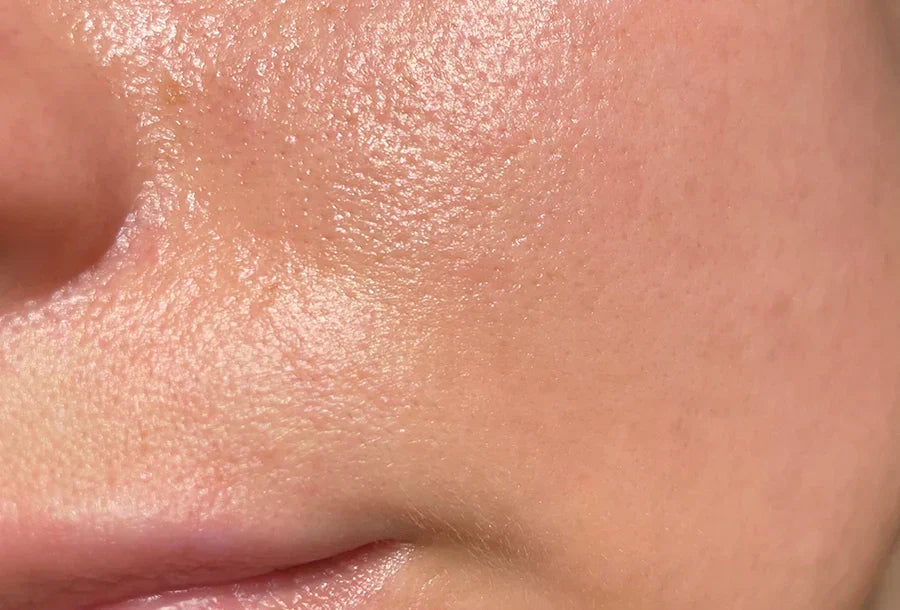 The Best Skincare Routine for Oily Skin: Step-by-Step Guide