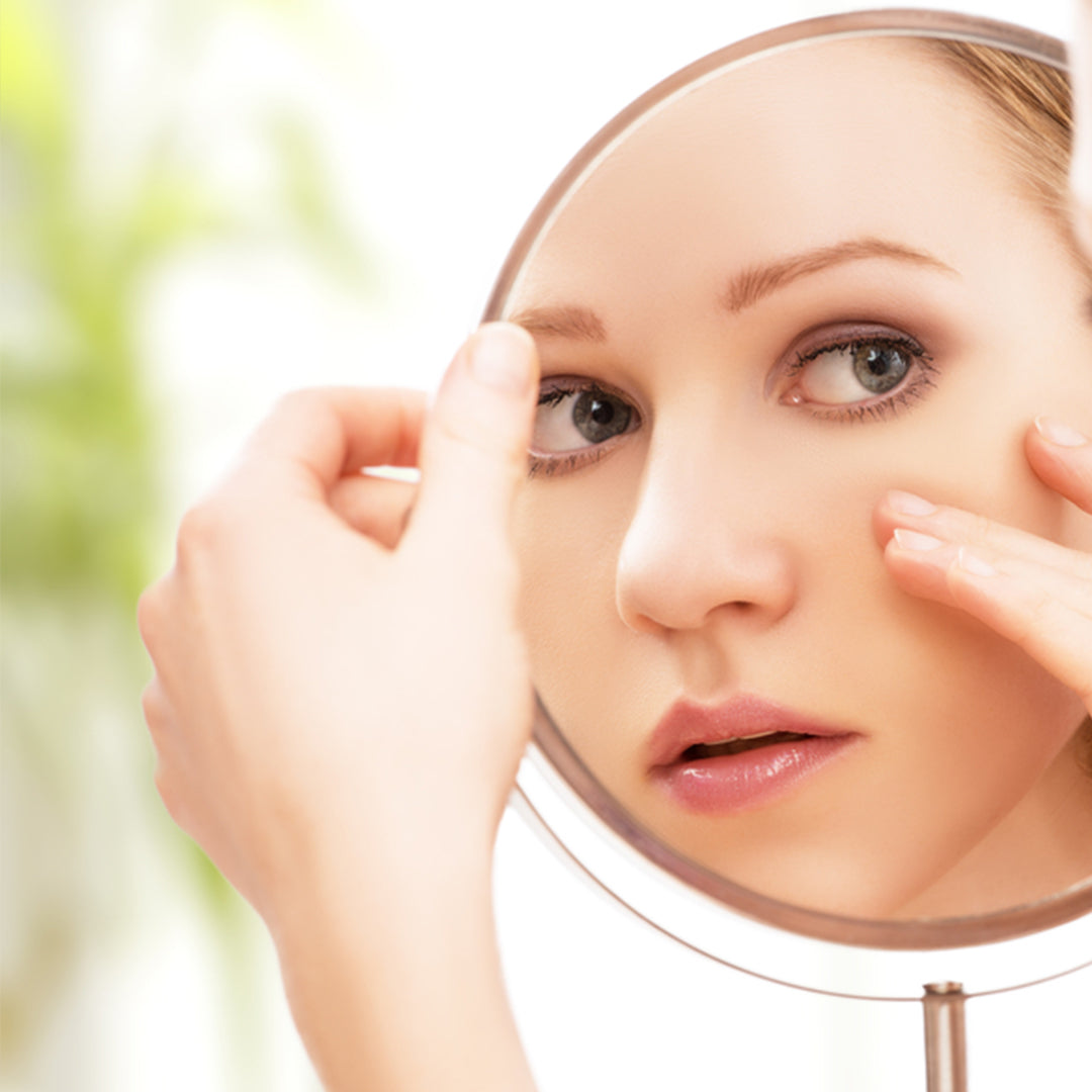 The Best Natural Ingredients for Acne-Prone Skin